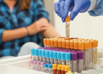Territorial de Salud de Caldas activa la recepción de muestras para la vigilancia de enfermedades de interés en salud pública