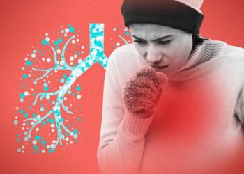 Territorial de Salud de Caldas hace un llamado a la prevención y detección oportuna de la tuberculosis, enfermedad que sigue presente en el departamento